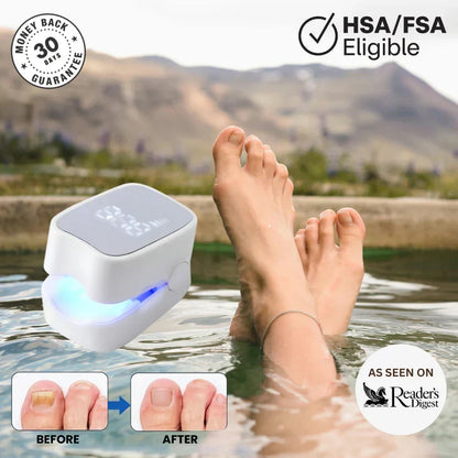 Maylo Pro™ - Nail Fungus Laser Device